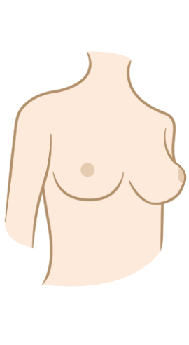 Breasts Surgery